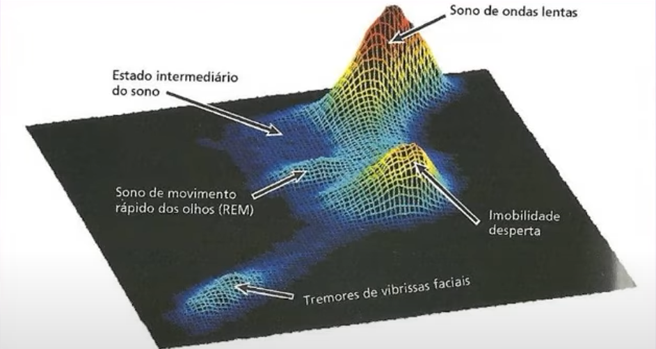 vibration of the brain